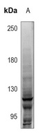NOTCH1 Rabbit Polyclonal Antibody