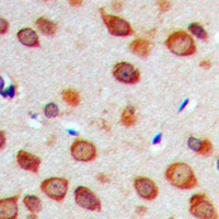 NOTCH1 Rabbit Polyclonal Antibody
