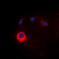 NOTCH1 Rabbit Polyclonal Antibody