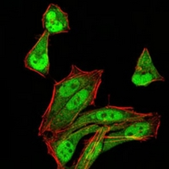 MGMT Mouse Monoclonal Antibody