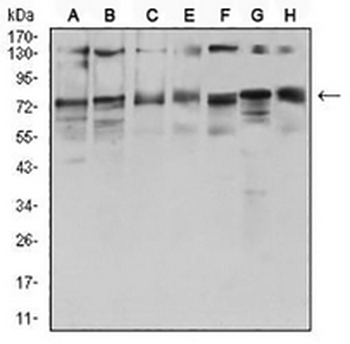 GFAT Mouse Monoclonal Antibody