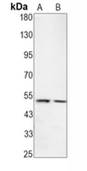 TPH1 Rabbit Monoclonal Antibody
