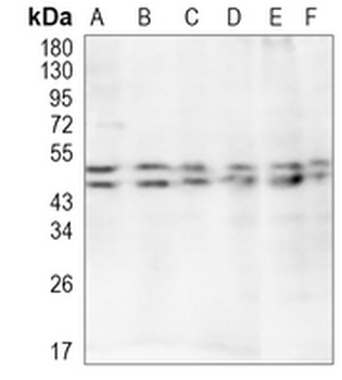 PAX6 Rabbit Monoclonal Antibody