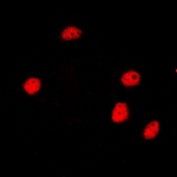 SMRT Rabbit Polyclonal Antibody