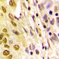 Histone H4 (Acetyl-K5) Rabbit Polyclonal Antibody