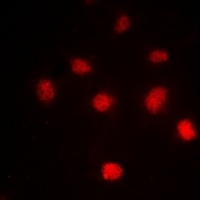 Histone H4 (Acetyl-K5) Rabbit Polyclonal Antibody