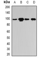 PYGL Rabbit Polyclonal Antibody