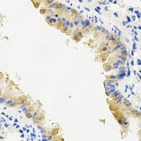 PYGL Rabbit Polyclonal Antibody