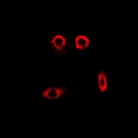 PYGL Rabbit Polyclonal Antibody