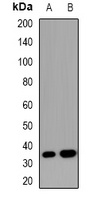 SOCS2 Rabbit Polyclonal Antibody