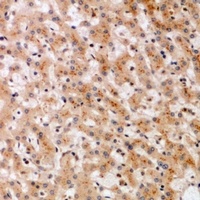 SOCS2 Rabbit Polyclonal Antibody