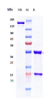 IL-17/IL-17A/CTLA-8 Antibody