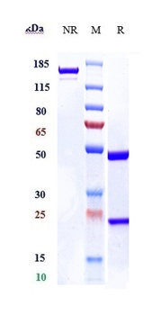 IL-17/IL-17A/CTLA-8 Antibody