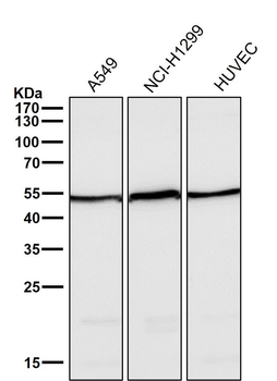 Angiopoietin 2 Rabbit mAb Antibody