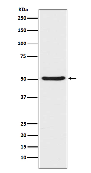Angiopoietin 2 Rabbit mAb Antibody
