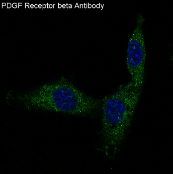 PDGF Receptor beta Rabbit mAb Antibody