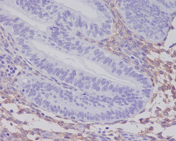 PDGF Receptor beta Rabbit mAb Antibody