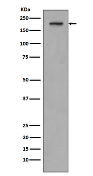 PDGF Receptor beta Rabbit mAb Antibody