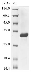 Anemonia sulcata GFP-like non-fluorescent chromoprotein FP595 protein