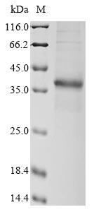 Anemonia sulcata GFP-like non-fluorescent chromoprotein FP595 protein