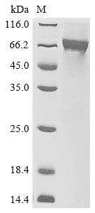 Recombinant Crimean-Congo hemorrhagic fever virus Envelopment polyprotein (GP), partial