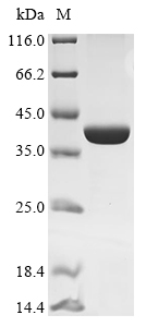 Pseudomonas cichorii D-tagatose 3-epimerase Protein