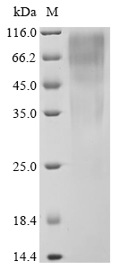 Human SOX9 Protein