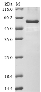 Human PAX6 Protein