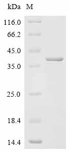 Recombinant Bordetella pertussis Pertussis toxin subunit 1 (ptxA)
