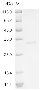 Recombinant Human Chymotrypsin-C (CTRC)
