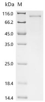 Recombinant Human DNA repair protein RAD50 (RAD50), partial