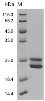 Recombinant Aspergillus niger Probable endo-1,4-beta-xylanase B (xlnB)