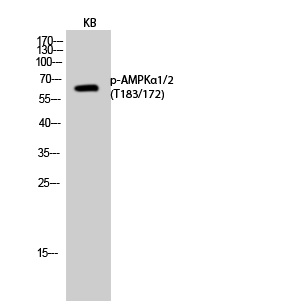 Phospho-AMPK alpha 1/2 (Thr183/Thr172) Rabbit pAb