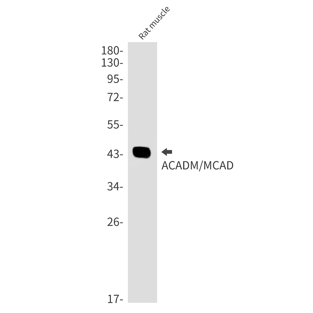 ACADM Rabbit mAb