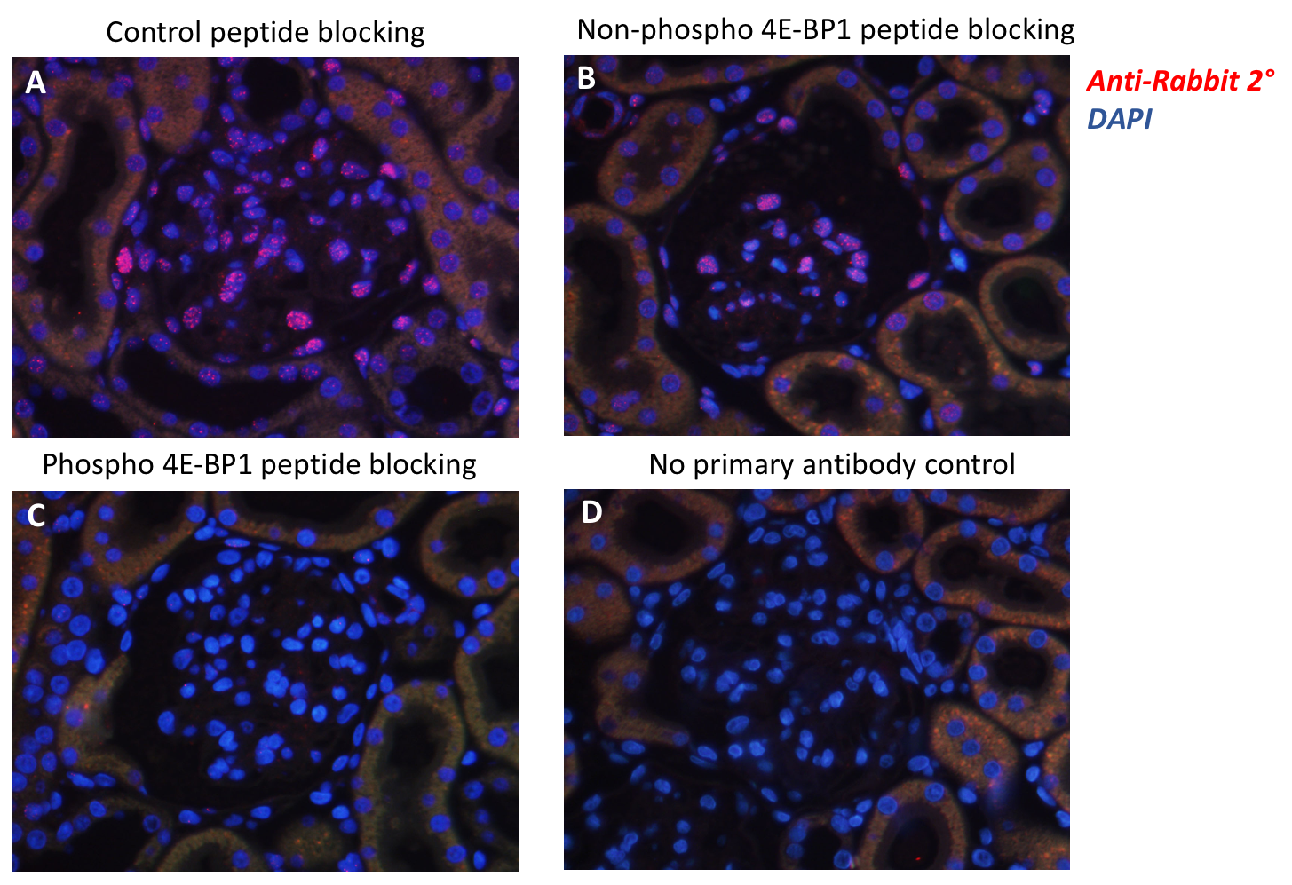 Phospho-4E-BP1 (Thr37/46) rabbit mAb Antibody