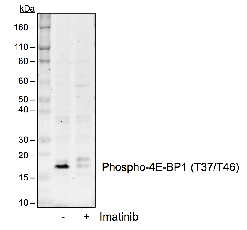 Phospho-4E-BP1 (Thr37/46) rabbit mAb Antibody