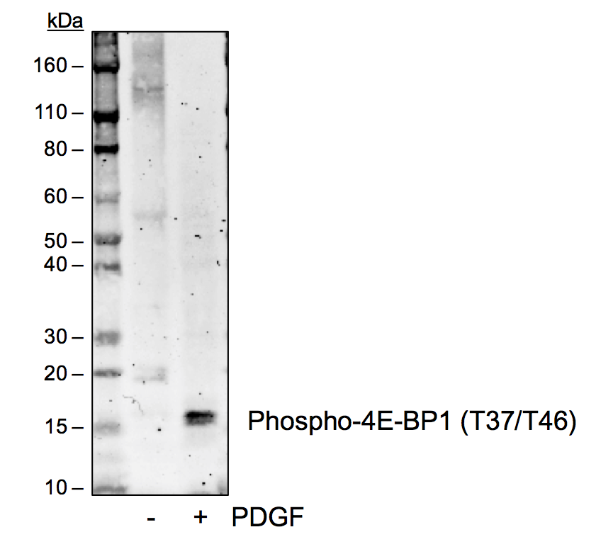 Phospho-4E-BP1 (Thr37/46) rabbit mAb Antibody