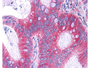 RELA Antibody