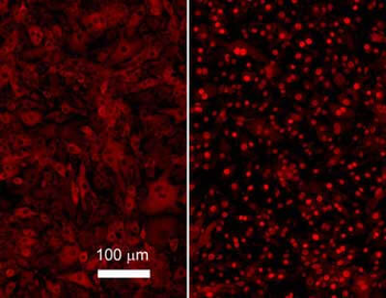 RELA Antibody