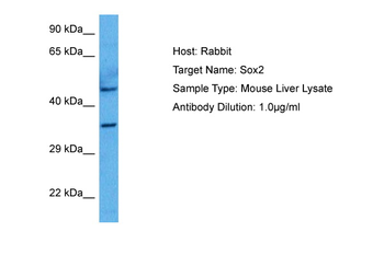 SOX2 Rabbit Polyclonal Antibody