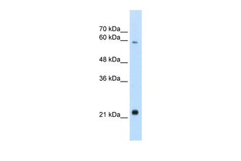 RBPJL Rabbit Polyclonal Antibody