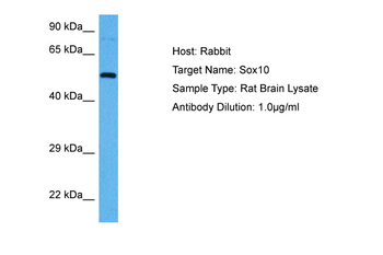 SOX9 Rabbit Polyclonal Antibody