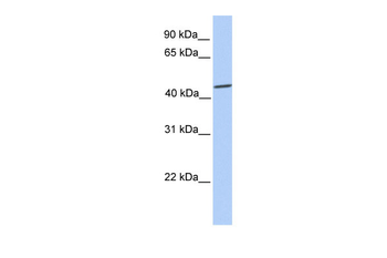 SOX9 Rabbit Polyclonal Antibody