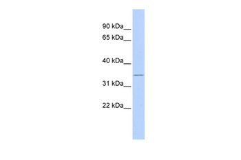 ZFP36L1 Rabbit Polyclonal Antibody