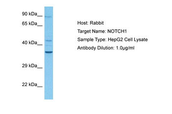 NOTCH1 Rabbit Polyclonal Antibody
