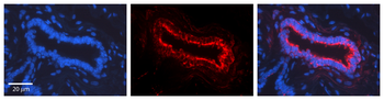 NOTCH1 Rabbit Polyclonal Antibody