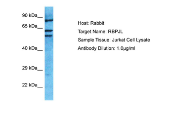 RBPJL Rabbit Polyclonal Antibody