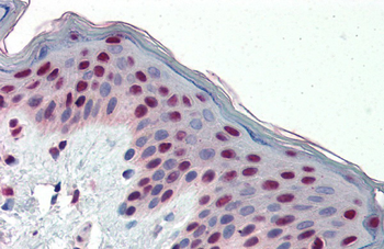 FOSL1 Rabbit Polyclonal Antibody