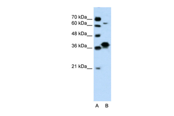 FOSL1 Rabbit Polyclonal Antibody