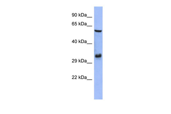 FOSL1 Rabbit Polyclonal Antibody